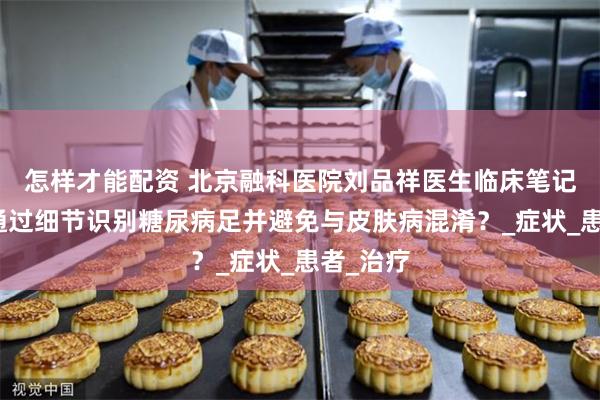 怎样才能配资 北京融科医院刘品祥医生临床笔记：如何通过细节识别糖尿病足并避免与皮肤病混淆？_症状_患者_治疗
